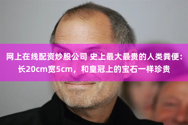 网上在线配资炒股公司 史上最大最贵的人类粪便：长20cm宽5cm，和皇冠上的宝石一样珍贵